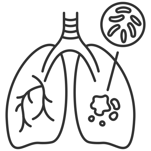 Tuberculosis